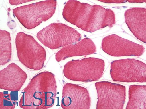 Anti-SHISA3 antibody IHC staining of human skeletal muscle. Immunohistochemistry of formalin-fixed, paraffin-embedded tissue after heat-induced antigen retrieval.