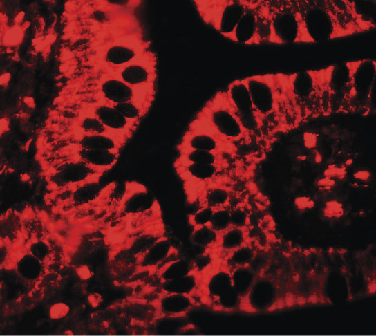 Immunofluorescence of SHISA3 in human small intestine tissue with SHISA3 antibody at 20 ug/ml.