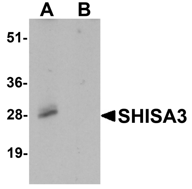 Western blot analysis of SHISA3 in human small intestine Tissue lysate with SHISA3 antibody at 1 ug/ml in (A) the absence and (B) the presence of blocking peptide.
