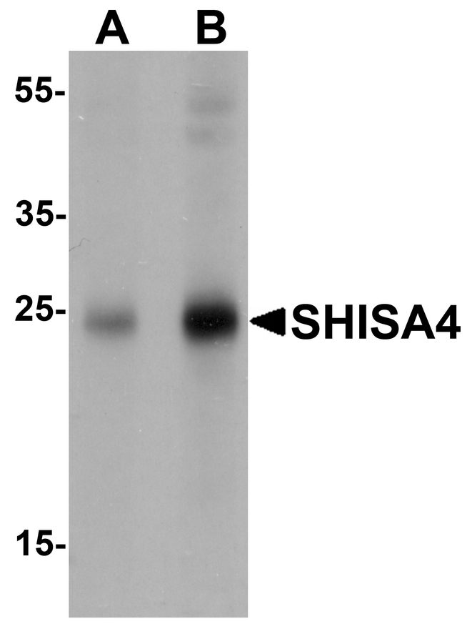 Western blot analysis of SHISA4 in human brain tissue lysate with SHISA4 antibody at (A) 1 and (B) 2 ug/ml.