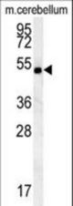 hCG_2039146 Antibody western blot of mouse cerebellum tissue lysates (15 ug/lane). The CG_2039146 antibody detected CG_2039146 protein (arrow).