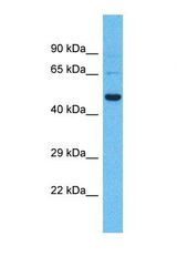 Western blot of Human Fetal Liver. SHISA9 antibody dilution 1.0 ug/ml.