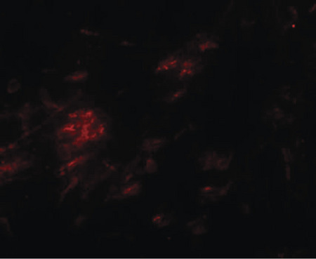 Immunofluorescence of SHISA9 in human brain tissue with SHISA9 antibody at 20 ug/ml.