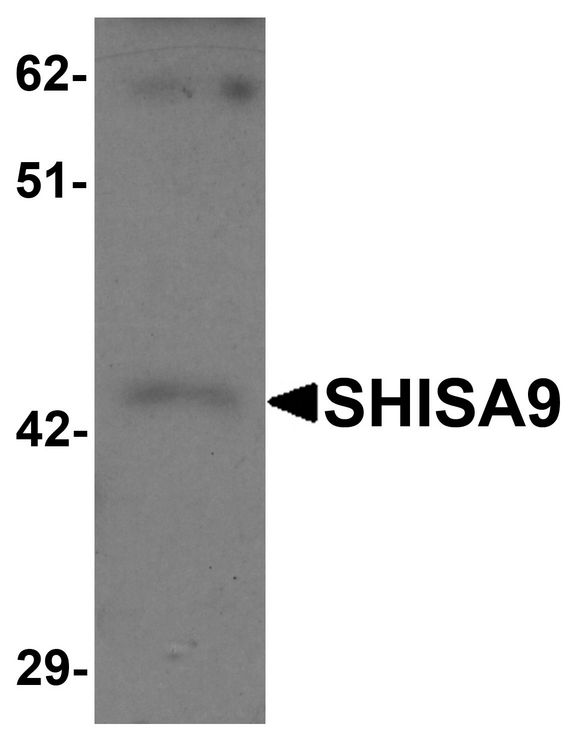 Western blot analysis of SHISA9 in rat brain tissue lysate with SHISA9 antibody at 1 ug/ml.
