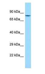 SHKBP1 antibody Western Blot of HepG2.