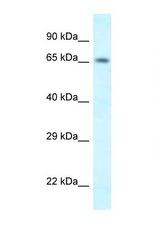 SHKBP1 antibody LS-C145589 Western blot of Mouse Pancreas lysate. Antibody concentration 1 ug/ml.