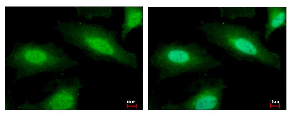 PSMF1 antibody [C2C3], C-term detects PSMF1 protein at Cytoplasm and Nucleus by immunofluorescent analysis. HeLa cells were fixed in 4% paraformaldehyde at RT for 15 min. PSMF1 protein stained by PSMF1 antibody [C2C3], C-term diluted at 1:500. 