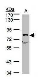 Sample (30 ug of whole cell lysate). A: A431, B: H1299. 7.5% SDS PAGE. SHKBP1 antibody diluted at 1:500