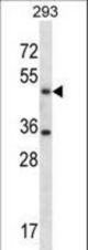 SHMT1 Antibody western blot of 293 cell line lysates (35 ug/lane). The SHMT1 antibody detected the SHMT1 protein (arrow).