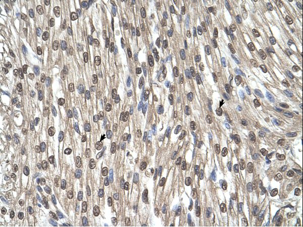 SHMT2 antibody LS-C80836 was used in IHC to stain formalin-fixed, paraffin-embedded human heart.
