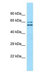 SHOC2 antibody Western Blot of Jurkat cell lysate.