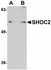 Western blot of SHOC2 in Jurkat cell lysate with SHOC2 antibody at (A) 1 and (B) 2 ug/ml. Below: Immunohistochemistry of SHOC2 in human spleen tissue with SHOC2 antibody at 5 ug/ml.