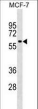 SHOC2 Antibody western blot of MCF-7 cell line lysates (35 ug/lane). The SHOC2 antibody detected the SHOC2 protein (arrow).