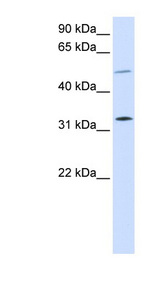 SHOX2 antibody LS-C112148 Western blot of 293T cell lysate.