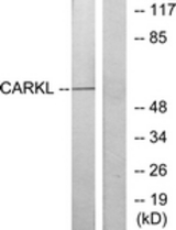 Western blot of extracts from Jurkat cells, using CARKL Antibody. The lane on the right is treated with the synthesized peptide.