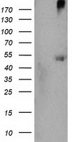HEK293T cells were transfected with the pCMV6-ENTRY control (Left lane) or pCMV6-ENTRY SHPK (Right lane) cDNA for 48 hrs and lysed. Equivalent amounts of cell lysates (5 ug per lane) were separated by SDS-PAGE and immunoblotted with anti-SHPK.