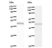 Left : Western blot analysis of immunized recombinant protein, using anti-SHPRH monoclonal antibody. Right : CBB staining of immunized recombinant protein.