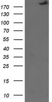 HEK293T cells were transfected with the pCMV6-ENTRY control (Left lane) or pCMV6-ENTRY SHPRH (Right lane) cDNA for 48 hrs and lysed. Equivalent amounts of cell lysates (5 ug per lane) were separated by SDS-PAGE and immunoblotted with anti-SHPRH.