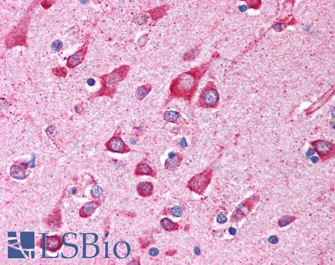 Anti-SHPRH antibody IHC of human brain, cortex. Immunohistochemistry of formalin-fixed, paraffin-embedded tissue after heat-induced antigen retrieval. Antibody LS-B308 concentration 5 ug/ml.