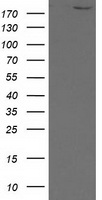 HEK293T cells were transfected with the pCMV6-ENTRY control (Left lane) or pCMV6-ENTRY SHPRH (Right lane) cDNA for 48 hrs and lysed. Equivalent amounts of cell lysates (5 ug per lane) were separated by SDS-PAGE and immunoblotted with anti-SHPRH.