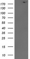 HEK293T cells were transfected with the pCMV6-ENTRY control (Left lane) or pCMV6-ENTRY SHPRH (Right lane) cDNA for 48 hrs and lysed. Equivalent amounts of cell lysates (5 ug per lane) were separated by SDS-PAGE and immunoblotted with anti-SHPRH.
