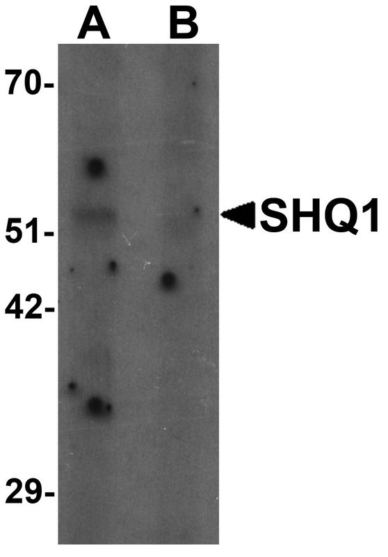 Western blot analysis of SHQ1 in human heart tissue lysate with SHQ1 antibody at 1 ug/ml in (A) the absence and (B) the presence of blocking peptide.