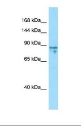 Western blot of Jurkat. CDKL1 antibody dilution 1.0 ug/ml.
