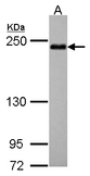 Sample (30 ug of whole cell lysate). A: Hep G2. 5% SDS PAGE. SHROOM2 antibody diluted at 1:500.