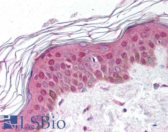 Anti-SHFM1 antibody IHC of human skin. Immunohistochemistry of formalin-fixed, paraffin-embedded tissue after heat-induced antigen retrieval. Antibody LS-B899 concentration 10 ug/ml.