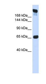 SI / Alpha-Glucosidase antibody LS-C102144 Western blot of Fetal Muscle lysate.