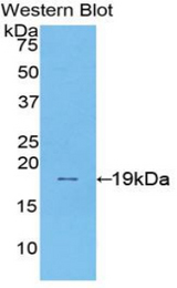 Western blot of recombinant SI / Alpha-Glucosidase.