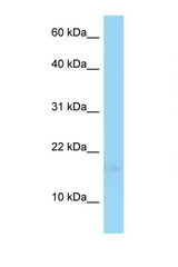 PSORS1C1 antibody LS-C146269 Western blot of Jurkat Cell lysate. Antibody concentration 1 ug/ml.