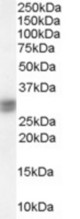 SIAH1 antibody staining (0.1 ug/ml) of Human Liver lysate (RIPA buffer, 30g total protein per lane). Primary incubated for 1 hour. Detected by Western blot of chemiluminescence.
