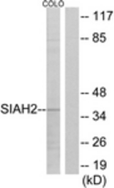 Western blot of extracts from COLO cells, using SIAH2 Antibody. The lane on the right is treated with the synthesized peptide.