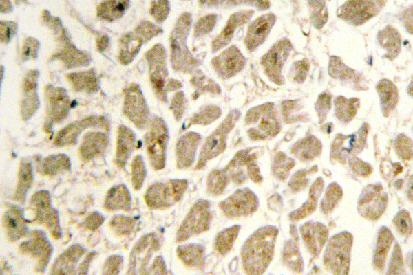 IHC of Siah-2 (E266) pAb in paraffin-embedded human heart tissue.