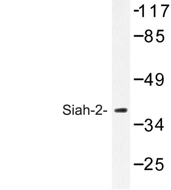 Western blot of Siah-2 (E266) pAb in extracts from COLO cells.