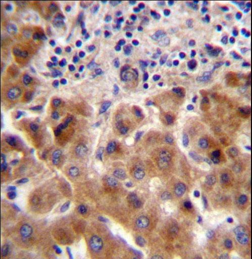 PSORS1C1 Antibody immunohistochemistry of formalin-fixed and paraffin-embedded human liver tissue followed by peroxidase-conjugated secondary antibody and DAB staining.
