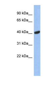 SIAH2 antibody LS-C109768 Western blot of Fetal Muscle lysate.