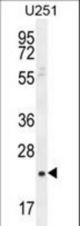 SIAH3 Antibody western blot of U251 cell line lysates (35 ug/lane). The SIAH3 antibody detected the SIAH3 protein (arrow).