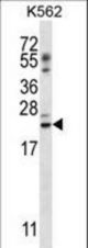 PSORS1C1 Antibody western blot of K562 cell line lysates (35 ug/lane). The PSORS1C1 antibody detected the PSORS1C1 protein (arrow).