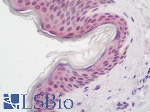 Anti-SIDT2 antibody IHC staining of human skin. Immunohistochemistry of formalin-fixed, paraffin-embedded tissue after heat-induced antigen retrieval. Antibody LS-B11312 dilution 1:50.