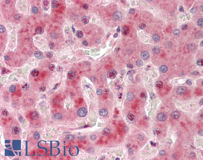 Human Liver: Formalin-Fixed, Paraffin-Embedded (FFPE)