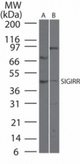Western blot of SIGIRR in40 ugs of A) HCT-116 and B) A549cell lysate using antibody at 1:500 dilution.