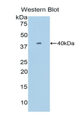 Western blot of recombinant SIGIRR.