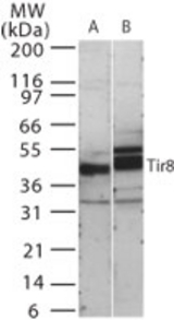 Western blot of human TIR8 in 15 ugs of (A) human kidney and (B) mouse kidney cell lysate using antibody at 0.5 ug/ml.