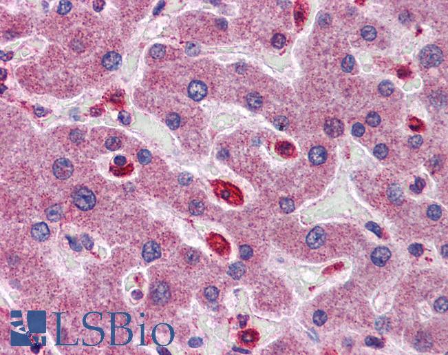 Anti-SIGIRR antibody IHC of human liver. Immunohistochemistry of formalin-fixed, paraffin-embedded tissue after heat-induced antigen retrieval. Antibody LS-B5817 concentration 5 ug/ml.