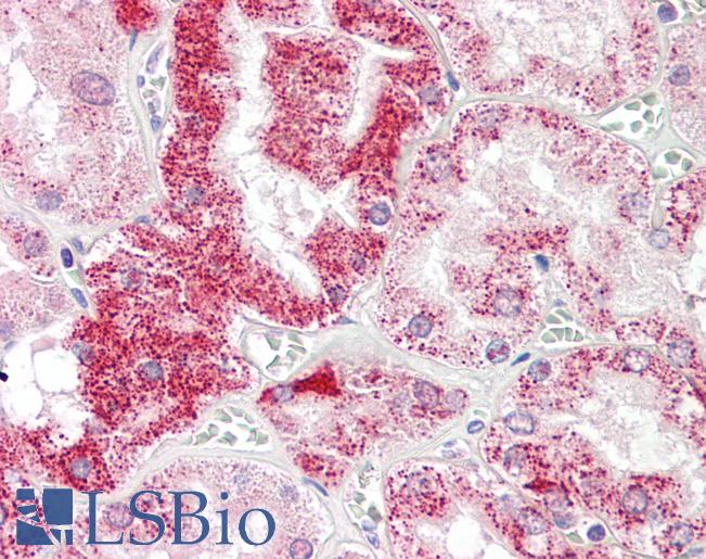 Anti-SIGLEC15 / SIGLEC-15 antibody IHC staining of human kidney. Immunohistochemistry of formalin-fixed, paraffin-embedded tissue after heat-induced antigen retrieval.