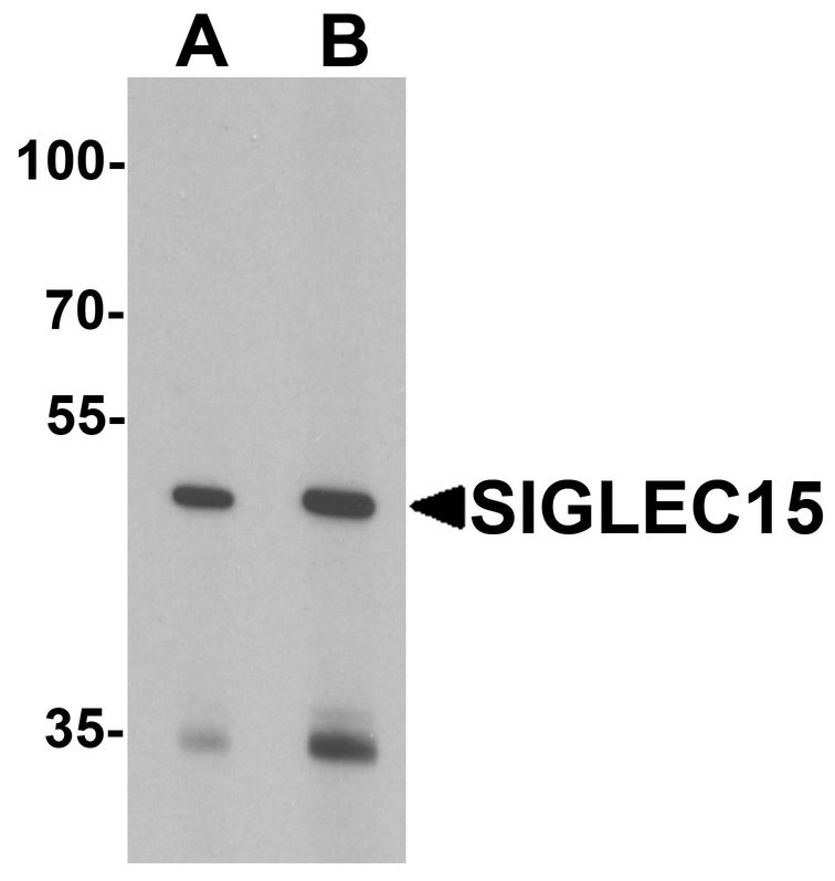 Western blot analysis of SIGLEC15 in K562 cell lysate with SIGLEC15 antibody at 1 ug/ml in (A) the absence and (B) the presence of blocking peptide.