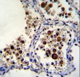 SIGLEC15 Antibody immunohistochemistry of formalin-fixed and paraffin-embedded human lung tissue followed by peroxidase-conjugated secondary antibody and DAB staining.