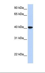 Fetal lung lysate. Antibody concentration: 1.0 ug/ml. Gel concentration: 12%.